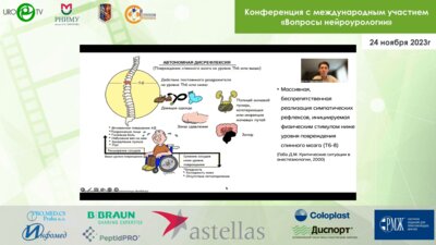 Бершадский А.В. - Нейроурология и кардиохирургия. Случай совместного лечения автономной дисрефлексии на фоне ТБСМ