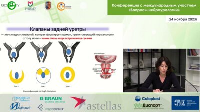 Соттаева З.З. - Клапаны задней уретры у мальчиков