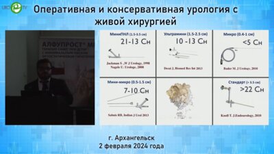 Горелов Д.С. - Камни почек менее 2 см. Какой метод удаления выбрать?