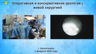 Горелов Д.С. - Уретеролитотрипсия с фиброкаликопиелолитотрипсией