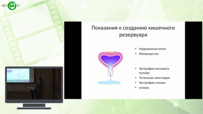 Даренков С.П., Пинчук И.С., Коварский С.Л., Захаров А.И., Петрухина Ю.В. - Артифициальный мочевой пузырь у ребенка с клоакой
