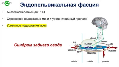 Еникеев М.Э. - Гибридная реконструкция тазовой фасции при урогенитальном пролапсе