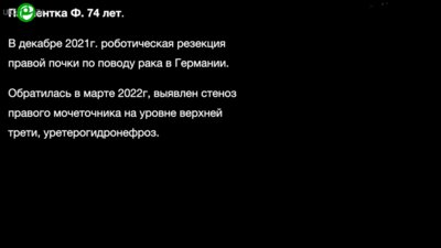 Григорьев Н.А., Коваленко А.В., Тедеев Р.Л. - Стент Allium. Внутри и снаружи