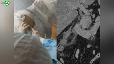 Ершов А.В., Бережной А.Г. - «Рутинная» ПНЛ