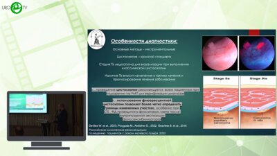 Карандашов В.К. - Применение фотодинамический диагностики и терапии в лечении рака мочевого пузыря