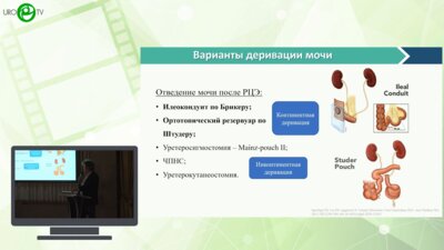 Румянцева Д.И., Носов А.К., Мамижев Э.М., Щекутеев Н.А. - Дефекты уретероилеоанастомозов после радикальной цистэктомии с кишечной деривацией мочи