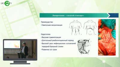 Мамижев Э.М. - Робот-ассистированная забрюшинная лимфаденэктомия у пациентов с ГО яичка при аномалиях развития почек