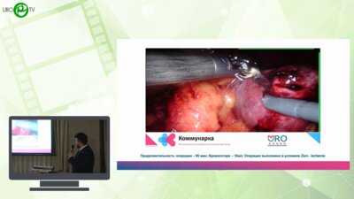 Котов С.В., Тызьо Д.В., Кобзев Д.С., Юсуфов А.Г., Гуспанов Р.И., Мещанкин И.В., Пироженко Г.А. - Хирургия единственной почки