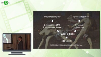 Глинин К.И. - Тандемное стентирование мочеточника. Кому и как?