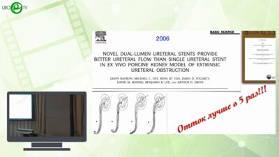 Григорьев Н.А. - Тандемное стентирование верхних мочевых путей