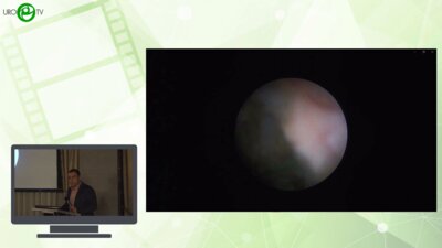 Саркисян А.Д. - Эндо и лапаро-доступы в стриктуры мочеточника