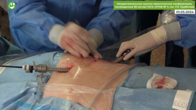 Галлямов Э.А. - Люмбоскопическая резекция почки