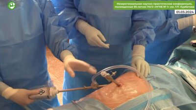 Лебедева А.А. - Люмбоскопическая нефруретерэктомия