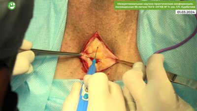 Байков Н.А. - Мужской слинг