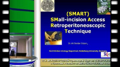 Али Сердар Гёзен  "Забрюшинная мини-лапароскопия (SMART-техника)"
