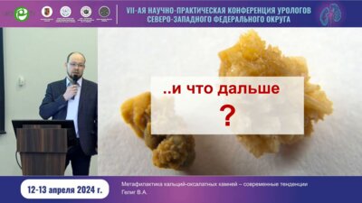 Гелиг В.А. - Метафилактика кальций-оксалатных камней - современные тенденции