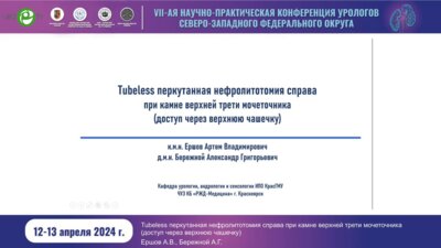 Ершов А.В. - Tubeless перкутанная нефролитотомия справа при камне верхней трети мочеточника (доступ через верхнюю чашечку)