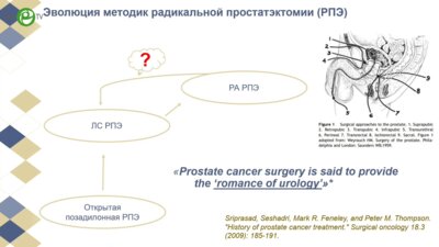 Носов А.К. - Робот-ассистированная хирургия в лечении рака простаты