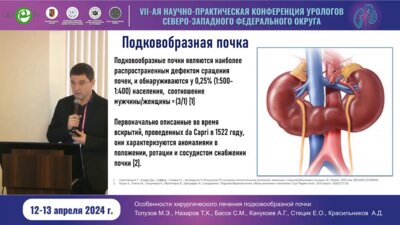 Басок С.М. - Особенности хирургического лечения подковообразной почки