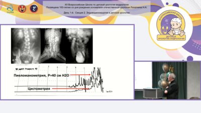 Бондаренко С.Г. - Лапароскопическая уретероцистопластика. Виды и техника операции