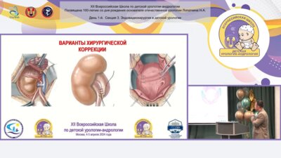 Пирогов А.В., Сизонов В.В, Коган М.И. - Селективная реимплантация мочеточника нижней половины удвоенных мочевых путей