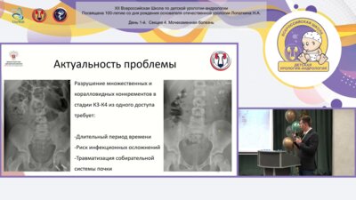 Вардак А.Б., Рудин Ю.Э., Арустамов Л.Д. - Перкутанная нефролитотрипсия у детей использованием нескольких нефростомических доступов