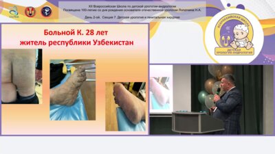 Жуков О.Б., Черных В.Б. - Клинический случай обширной венозной мальформации