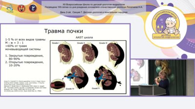 Пепеляева И.М. - Отдаленные результаты лечения детей с разрывом почки