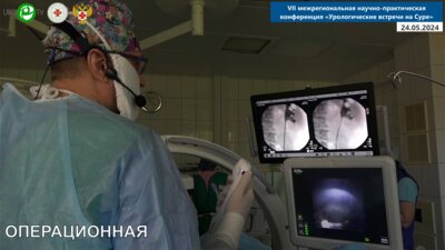 Миронов М.А. - 3 РИРХ. Фибронефролитотрипсия. Литовью