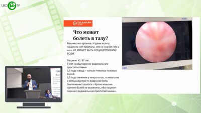 Диланян О.Э. - Лапароскопическая декомпрессия пудендального нерва и процедура L.I.O.N.