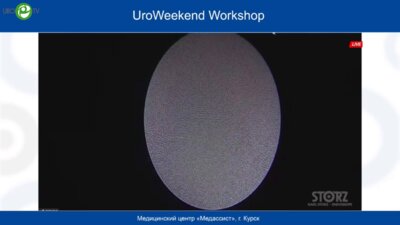 Малхасян В.А. - Ретроградная интраренальная хирургия