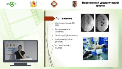 Пилипенко Е.В. - Хирургическое лечение МКБ. Комплексный подход
