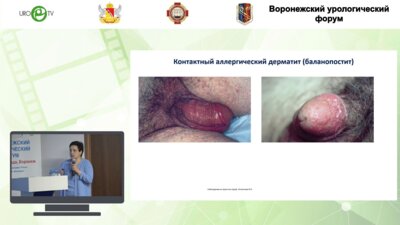 Шадёркина В.А. - Баланопостит - многоликий и междисциплинарный