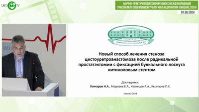 Гончаров Н.А. - Новый метод лечения цистоуретроанастомоза после радикальной простатэктомии