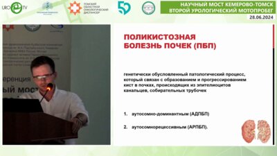 Иванов А.О. - Хирургическое лечение осложненного поликистоза почек