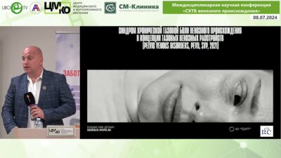 Деркач В.В. - СХТБ венозного происхождения в концепции тазовых венозных расстройств (pelvic venous disorders,PeVD, SVP, 2021)