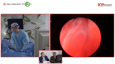 Бурлака О.О. - Гольмиевая высокоэнергетическая энуклеация простаты с технологией Moses (HoLep)
