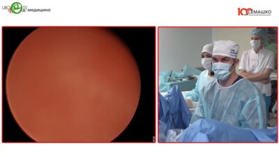 Дымов А.М. - Тулиевая энуклеация простаты