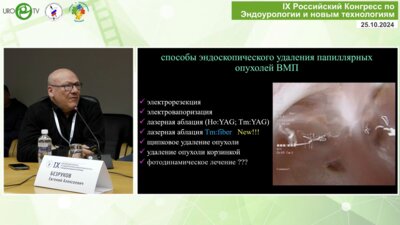 Мартов А.Г. - Эндоскопическое лечение уротелиального рака верхних мочевых путей