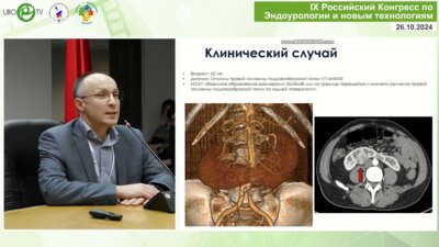 Пшихачев А.М. - Лапароскопическая резекция подковообразной почки с использованием ICG-визуализации