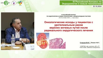 Старцев В.Ю.  - Онкологические исходы у пациентов с уротелиальным РВМП после радикальной хирургии