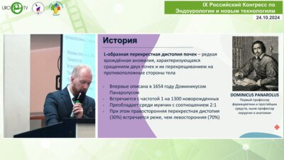 Ершов А.В. - Безнефростомная мини-ПНЛ у пациента с правосторонней L-образной перекрестной дистопией почек