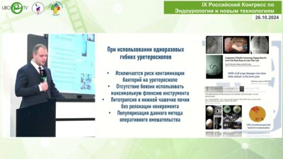 Сытник Д.А. - Настоящее и будущее в гибкой трансуретральной нефролитотрипсии