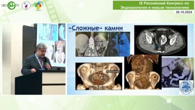 Феофилов И.В. - Рифы в перкутанной хирургии почки