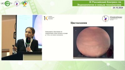 Волокитин Е.В. - Биполярная ТУР мочевого пузыря