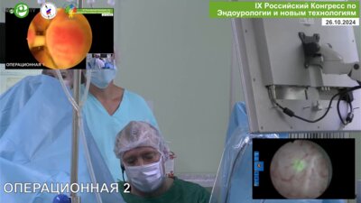 Болгов Е.Н. - Лазерная энуклеация ДГПЖ (лазер Lumenis)