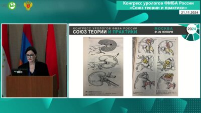 Хитрых А.М. - Место лапароскопии в лечении МКБ