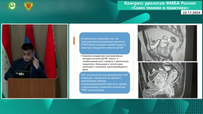 Макаров П.А. - Опыт энуклеаций предстательной железы в ЗСМЦ ФМБА России