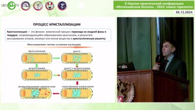 Войтко Д.А. - Возможности оценки антикристаллизационной активности мочи