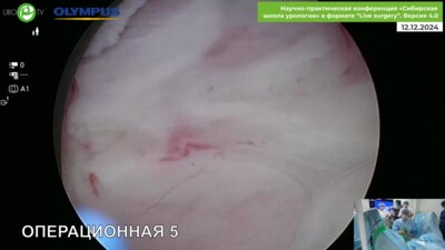 Болгов Е.Н. - ТУЛЭП